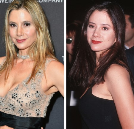 mira sorvino plastic surgery.